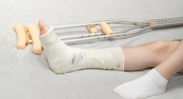 La Importancia de la Fisioterapia en la Recuperación de Fracturas