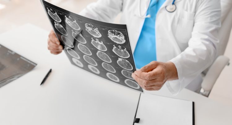 Rehabilitación en Pacientes con Lesiones Cerebrales Traumáticas