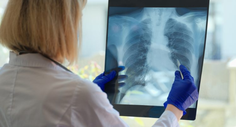 Rehabilitación Pacientes con Enfermedades Pulmonares Crónicas